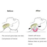 Almohada de columna cervical, masajeador de estiramiento, ortesis, almohada portátil para el cuello - Imagen 4