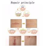 El parche de terapia de cicatrices de gel de silicona orgánica se lava y se reutiliza - Imagen 4