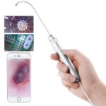 Supereyes Y001+ Endoscopio electrónico oral de garganta nasal con tubo enfocable de 4 mm